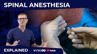 Spinal Anesthesia Explained Part 1 Crash course with Dr Hadzic [upl. by Basset]