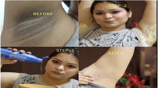 UNDERARMS WHITENING AT HOME100 EFFECTIVEINSTANT and FASTEST RESULT [upl. by Ysteb]