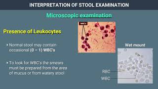 Interpretation of Stool Examination [upl. by Eikcuhc]