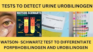 TESTS TO DETECT UROBILINOGEN IN THE URINE EhrlichsTEST PORPHOBILINOGEN TESTWatsonSchwartz Test [upl. by Suilenroc444]