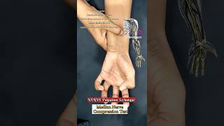 Nerve Palpation technique for upper limb radial nerve ulnar nerve median nerve [upl. by Nyrehtac]