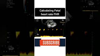 Fetal heart rate FHR ultrasound baby medical pregnancyjourney [upl. by Buford]