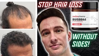 Why RU58841 is in My Hair Loss Protocol 2024 [upl. by Pax321]