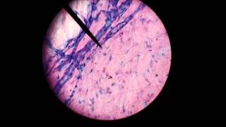 loose areolar tissue microscopic [upl. by Aldwin]