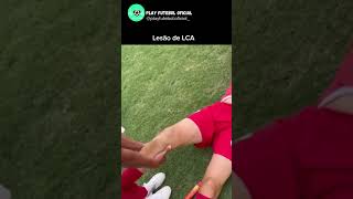 Lesão do ligamento cruzado anterior futebol neymar cristianoronaldo messi [upl. by Laehcim]