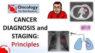 Cancer Diagnosis initial tests biopsy and tissue diagnosis staging and the MDT [upl. by Kenzi]