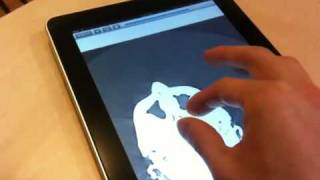 DICOM Viewer iPad [upl. by Margreta]