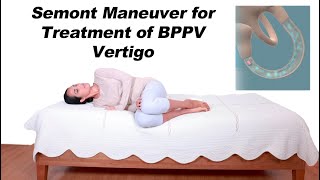 Semont Maneuver for BPPV Vertigo Treatment Alternative to Epley Maneuver [upl. by Yenor]