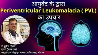 Periventricular Leukomalacia  Causes Symptoms and Treatment in Ayurveda  डॉ पुनीत द्विवेदी [upl. by Dosia217]