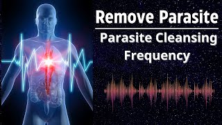 Frequency Of Purification From Parasites  Remove Parasite Worms Viruses Infections [upl. by Drofub482]