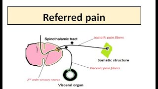 REFERRED PAIN [upl. by Oisangi756]