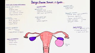 Benign Ovarian Tumors  Ovarian Cysts  histology  clinics [upl. by Jerri]