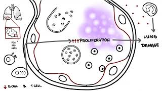 Pneumocystis jirovecii  Pneumocystis pneumonia [upl. by Ais]