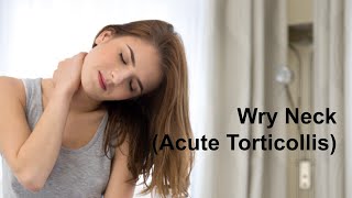 Wry Neck Acute Torticollis [upl. by Yelahs]