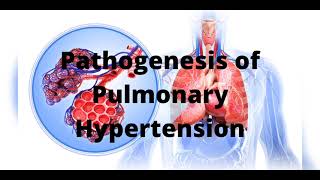 Pathogenesis of Pulmonary Hypertension [upl. by Nepil875]