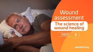 The Science of Wound Healing  Part 3 Wound Assessment [upl. by Crista]