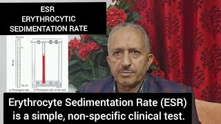 ESR Erythrocytic Sedimentation Rate [upl. by Caril]