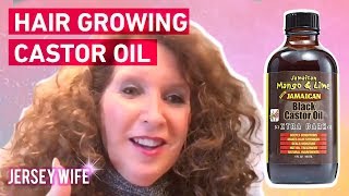 HAIR GROWING CASTOR OIL [upl. by Anada129]