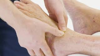 Inflammatory arthritis of the feet [upl. by Ahseital]