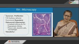 Rheumatoid Arthritis [upl. by Meldoh]