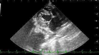 Echo image of the Restrictive cardiomyopathy in a cat （猫の拘束型心筋症のエコー） [upl. by Pugh]