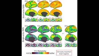 MultiEcho Sequences and RestingState fMRI [upl. by Nandor]