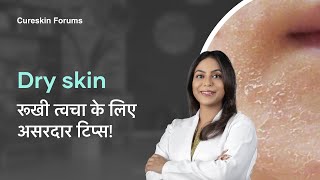 Dry skin ka kese rakhein khayal  Cureskin Dermatologist [upl. by Akeit556]