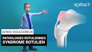 Syndrome Rotulien  Explication  EPITACT [upl. by Ailyn]