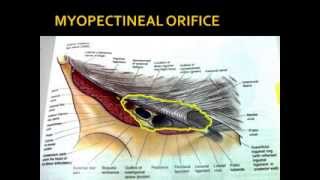 Anatomy of Inguinal Canal [upl. by Emelia]