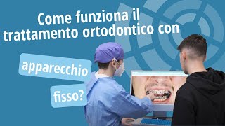 Trattamento ortodontico con apparecchio fisso come funziona  Studio Ortodontico Cocconi Rapa [upl. by Linnet]