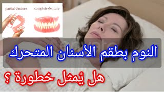 النوم بطقم الأسنان المتحرك، هل له خطورة؟ Dormir avec prothèse dentaire amovible [upl. by Spiros]