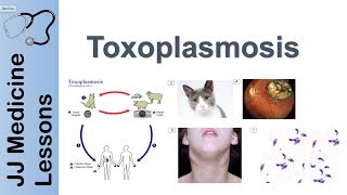 Toxoplasmosis  Acquired vs Congenital  Signs Symptoms Diagnosis and Treatment [upl. by Arnold306]