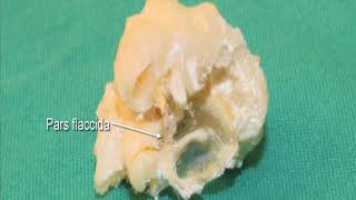 18 Step 7 Internal view of tympanic membrane and associated ossicles isolated specimen [upl. by Hsaniva]