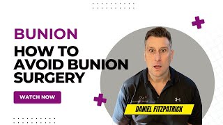 How To Avoid Bunion Surgery and Keep Active [upl. by Damha]