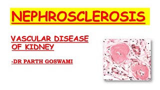 Nephrosclerosis [upl. by Flip]