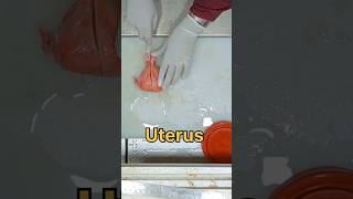 uterus with bilateral adnexa specimen [upl. by Zaneski7]