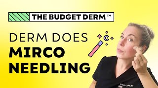 Dermatologist does athome Microneedling  Pros  Cons vs Inoffice treatment [upl. by Coco935]