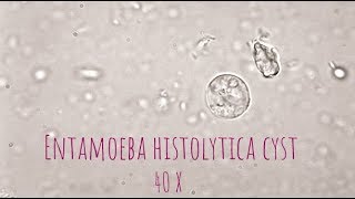 Entamoeba Histolytica cyst under microscope at 40X [upl. by Oniuqa145]