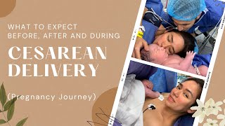 What to Expect Before After and During CS Pregnancy Journey by Danica SottoPingris [upl. by Dazraf64]