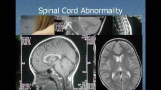 Dr Raymond Perrin The Perrin Technique Part 2 of 6 [upl. by Adlig]