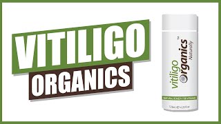 Vitiligo Organics [upl. by Onil]