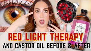 3 POWERFUL Castor Oil Benefits for THE FACE  WITH RED LIGHT THERAPY [upl. by Pooh2]