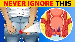 6 Signs of Colon Cancer You Should Know [upl. by Assennej]