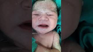 Look at the baby skin just after birth newbornbaby viralbabyshorts youtubeshorts babyshorts [upl. by Yehus995]