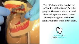 Assembling and Place Matrix Band amp Tofflemire Retainer  Academy for Dental Assistants [upl. by Navy274]