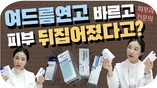 Eng 여드름연고 바르는법 바르는 순서 종류 부작용  Topical acne medication 피부과전문의 닥터필러 [upl. by Geno269]