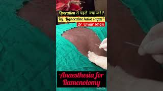 Rumenotomy l Bloat l Tympani l dr Umar khan [upl. by Adlemi377]