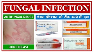 FUNGAL INFECTION  फंगल इंफेक्शन को ठीक करने की दवा  ANTIFUNGAL DRUGS  SKIN DISEASE TREATMENT [upl. by Sadella205]