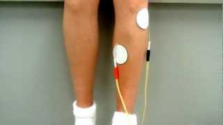 Tibialis Anterior Placement Correct One [upl. by Schwerin]