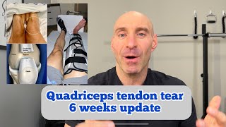 Quad tendon tear surgery 6 weeks update [upl. by Caasi436]